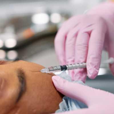 A close-up of a person getting an injection in their face, with a healthcare professional administering the treatment.